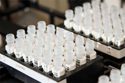 A rack of plastic sample tubes in a lab tray, ready for processing
